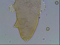 Mesocrista spitzbergensis image