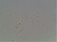 Mesocrista spitzbergensis image