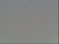 Mesocrista spitzbergensis image