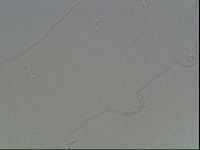Mesocrista spitzbergensis image