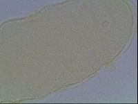 Pilatobius iltisi image