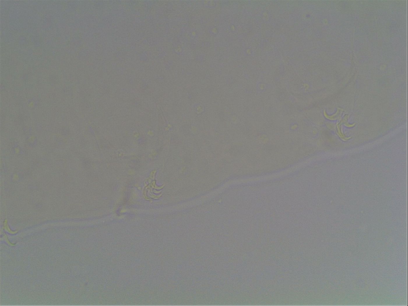 Diphascon higginsi image