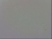 Doryphoribius evelinae image