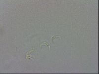 Doryphoribius evelinae image
