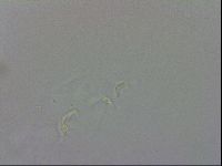 Doryphoribius evelinae image