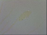 Doryphoribius evelinae image