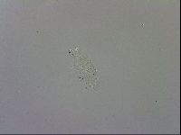 Doryphoribius evelinae image