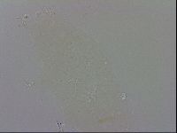 Doryphoribius evelinae image