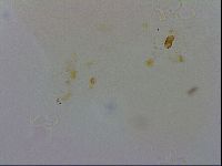 Doryphoribius evelinae image