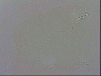 Media resource of Doryphoribius evelinae