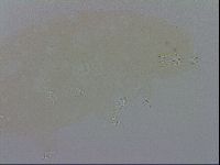 Doryphoribius evelinae image
