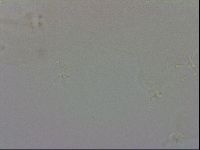 Doryphoribius evelinae image