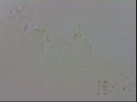 Doryphoribius evelinae image