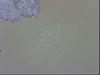Doryphoribius evelinae image