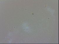 Doryphoribius evelinae image