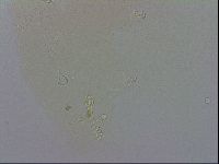 Doryphoribius evelinae image