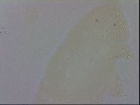 Doryphoribius evelinae image