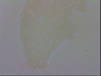 Doryphoribius evelinae image