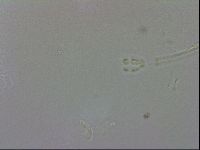 Doryphoribius evelinae image