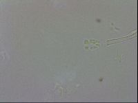 Doryphoribius evelinae image