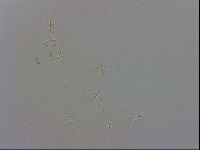 Doryphoribius evelinae image