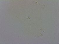 Doryphoribius evelinae image