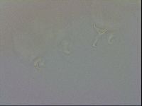Doryphoribius evelinae image