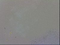 Doryphoribius evelinae image