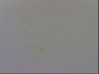 Doryphoribius evelinae image