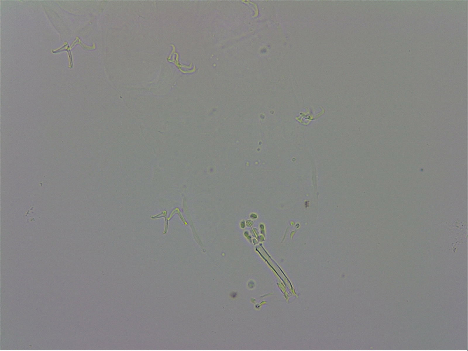 Doryphoribius evelinae image