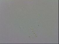 Doryphoribius evelinae image