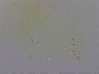 Doryphoribius evelinae image