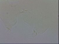 Doryphoribius evelinae image