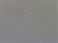 Doryphoribius evelinae image
