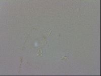 Doryphoribius evelinae image