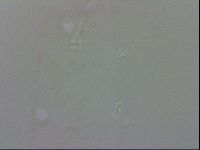Doryphoribius evelinae image