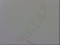 Doryphoribius evelinae image