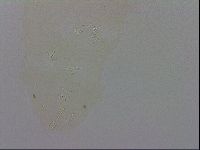 Doryphoribius evelinae image