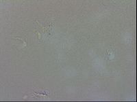 Doryphoribius evelinae image