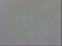 Doryphoribius evelinae image