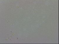 Doryphoribius evelinae image