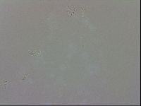 Doryphoribius evelinae image