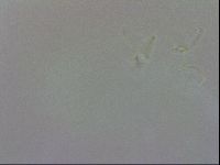 Doryphoribius evelinae image