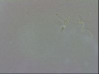 Doryphoribius evelinae image
