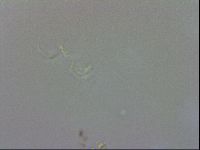 Doryphoribius evelinae image