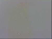Doryphoribius evelinae image