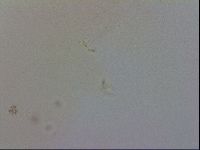 Doryphoribius evelinae image