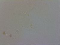 Doryphoribius evelinae image