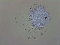 Doryphoribius evelinae image