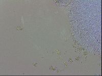 Doryphoribius evelinae image